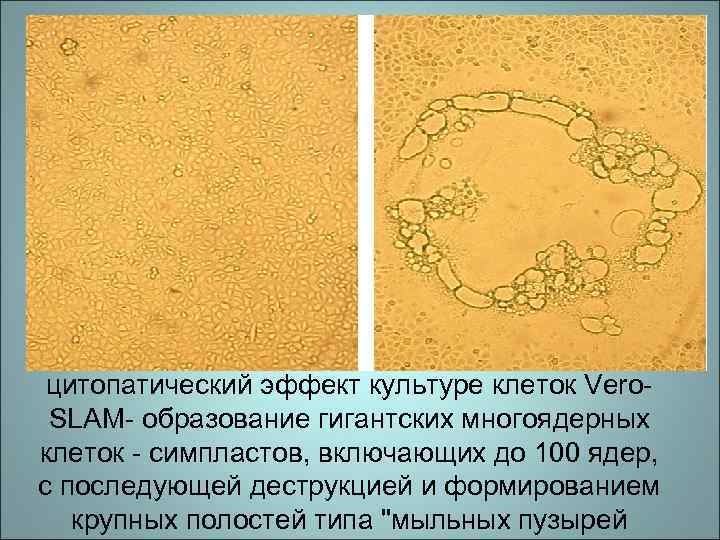 цитопатический эффект культуре клеток Vero. SLAM- образование гигантских многоядерных клеток - симпластов, включающих до