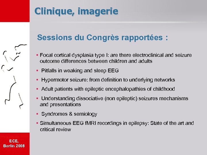 Clinique, imagerie Sessions du Congrès rapportées : § Focal cortical dysplasia type I: are