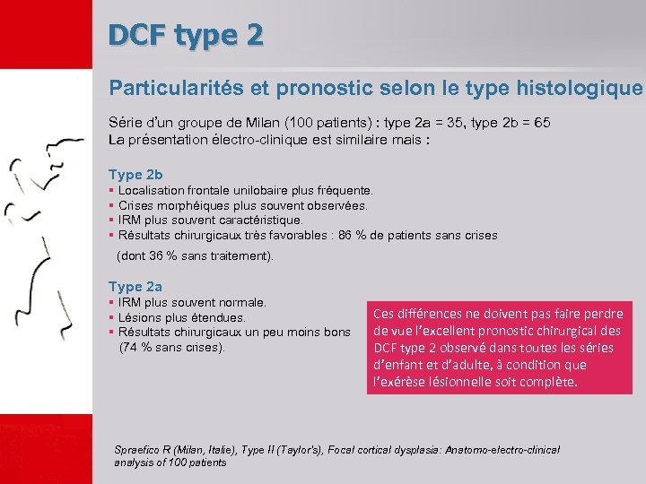 DCF type 2 Particularités et pronostic selon le type histologique Série d’un groupe de