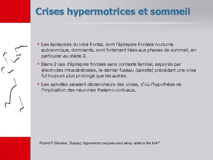 Crises hypermotrices et sommeil § Les épilepsies du lobe frontal, dont l’épilepsie frontale nocturne