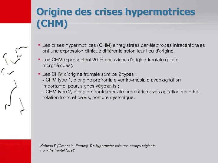 Origine des crises hypermotrices (CHM) § Les crises hypermotrices (CHM) enregistrées par électrodes intracérébrales