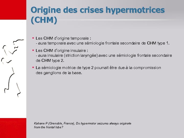 Origine des crises hypermotrices (CHM) § Les CHM d’origine temporale : - aura temporale