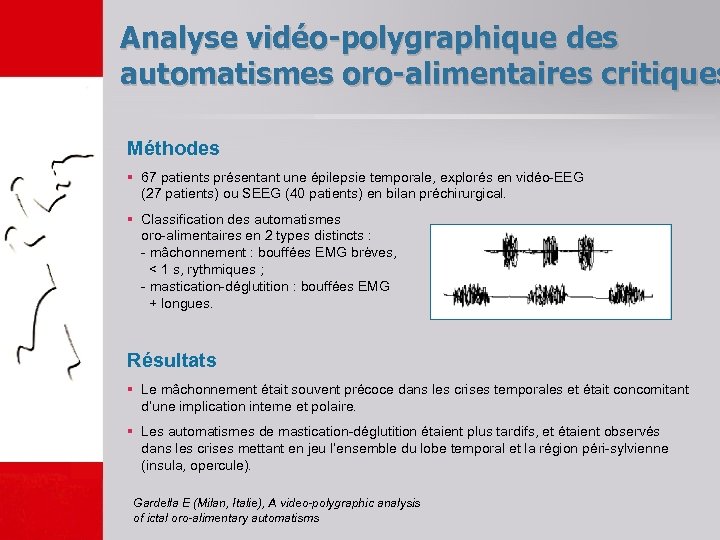 Analyse vidéo-polygraphique des automatismes oro-alimentaires critiques Méthodes § 67 patients présentant une épilepsie temporale,