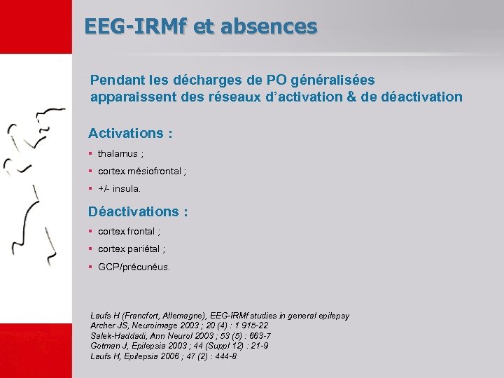 EEG-IRMf et absences Pendant les décharges de PO généralisées apparaissent des réseaux d’activation &
