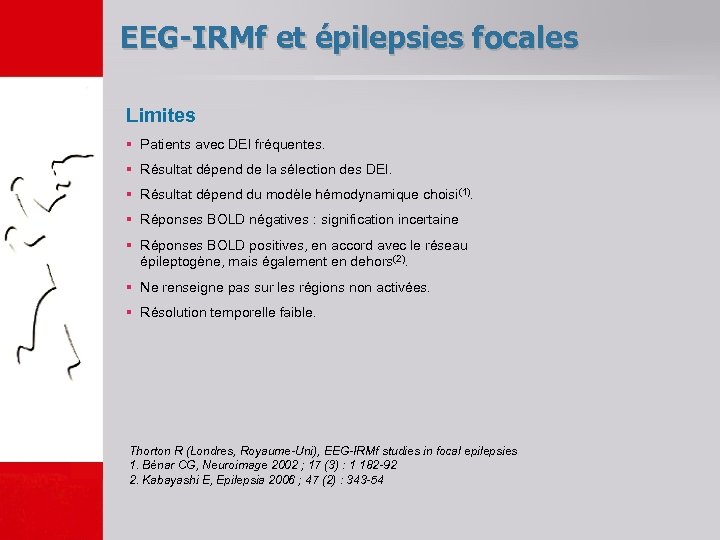 EEG-IRMf et épilepsies focales Limites § Patients avec DEI fréquentes. § Résultat dépend de