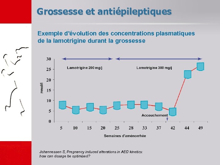 Grossesse et antiépileptiques Exemple d'évolution des concentrations plasmatiques de la lamotrigine durant la grossesse