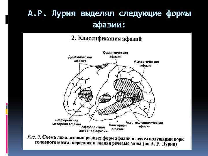 Афазии локализации поражения. Классификация афазии Лурия. Формами афазии и зонами поражения головного мозга. Классификация афазии по локализации поражения( по р.а. Лурии). Моторная афазия классификация.