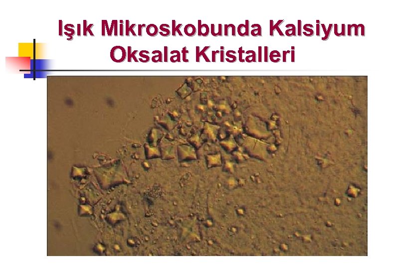 Işık Mikroskobunda Kalsiyum Oksalat Kristalleri 