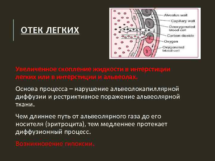 Презентация на тему отек легких