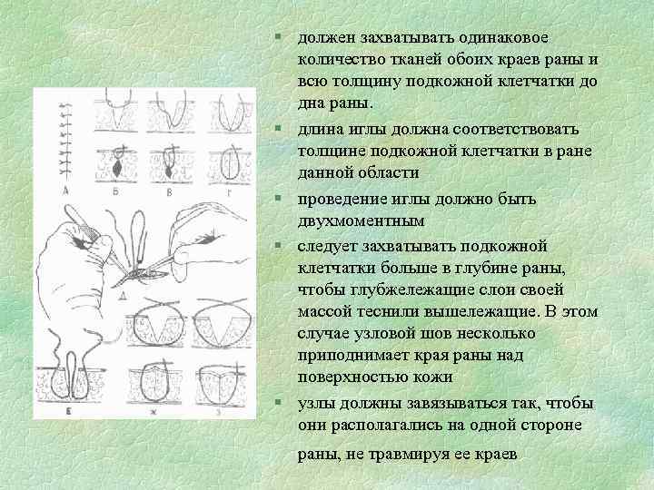 § должен захватывать одинаковое количество тканей обоих краев раны и всю толщину подкожной клетчатки