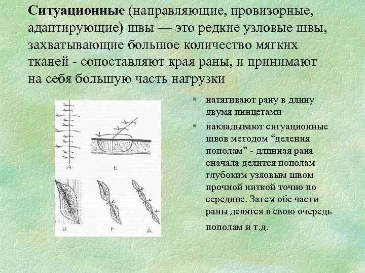 Схема хирургических швов