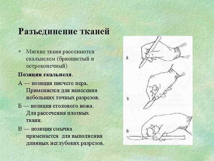 Разъединение тканей § Мягкие ткани рассекаются скальпелем (брюшистый и остроконечный) Позиции скальпеля. А —