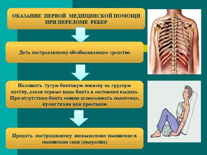 ОКАЗАНИЕ ПЕРВОЙ МЕДИЦИНСКОЙ ПОМОЩИ ПРИ ПЕРЕЛОМЕ РЕБЕР Дать пострадавшему обезболивающее средство Наложить тугую бинтовую