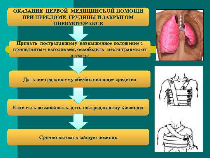 ОКАЗАНИЕ ПЕРВОЙ МЕДИЦИНСКОЙ ПОМОЩИ ПРИ ПЕРЕЛОМЕ ГРУДИНЫ И ЗАКРЫТОМ ПНЕВМОТОРАКСЕ Придать пострадавшему возвышенное положение