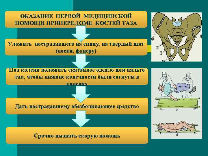 ОКАЗАНИЕ ПЕРВОЙ МЕДИЦИНСКОЙ ПОМОЩИ ПРИПЕРЕЛОМЕ КОСТЕЙ ТАЗА Уложить пострадавшего на спину, на твердый щит