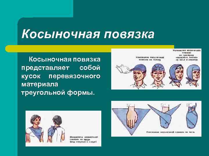 Косыночная повязка представляет собой кусок перевязочного материала треугольной формы. 