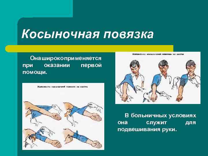 Косыночная повязка Она широко применяется при оказании первой помощи. В больничных условиях она служит