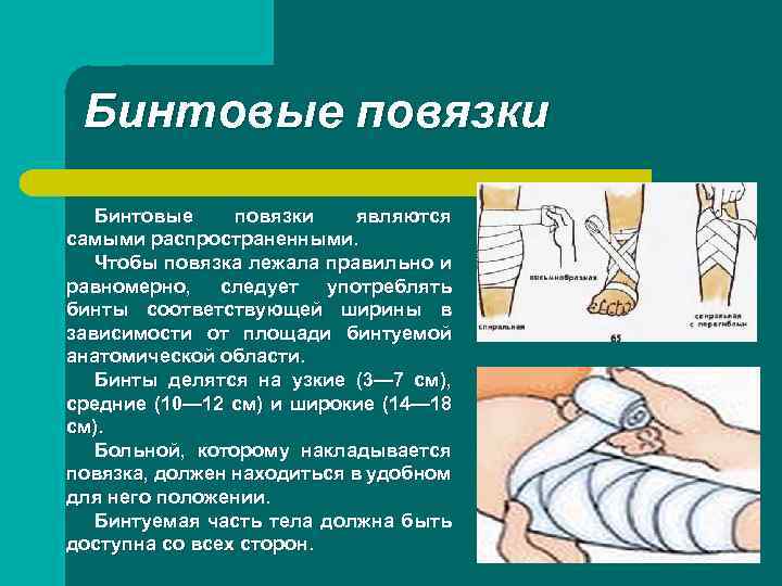 Бинтовые повязки являются самыми распространенными. Чтобы повязка лежала правильно и равномерно, следует употреблять бинты