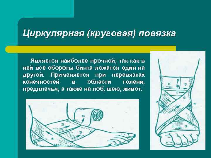 Циркулярная (круговая) повязка Является наиболее прочной, так как в ней все обороты бинта ложатся