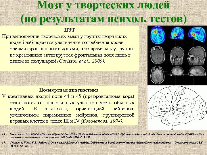 Мозг у творческих людей (по результатам психол. тестов) ПЭТ При выполнении творческих задач у