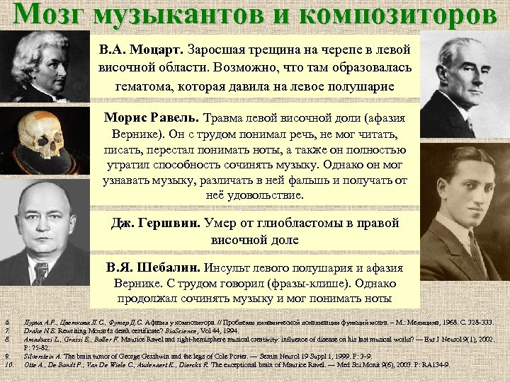 Мозг музыкантов и композиторов В. А. Моцарт. Заросшая трещина на черепе в левой височной