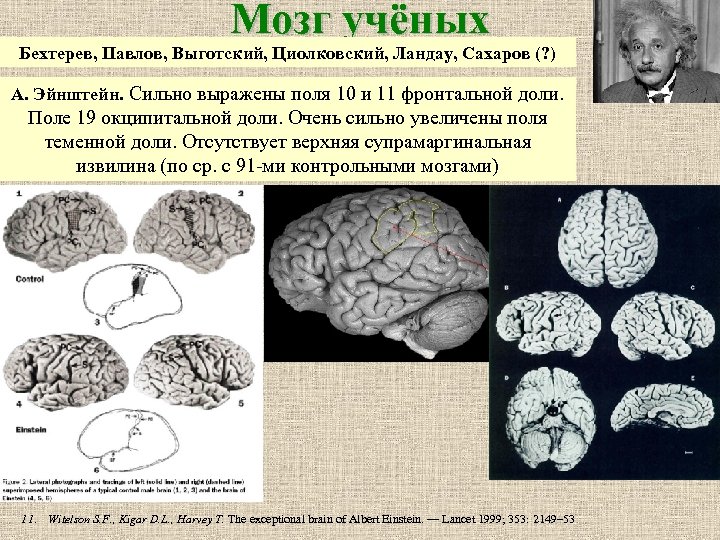 Мозг учёных Бехтерев, Павлов, Выготский, Циолковский, Ландау, Сахаров (? ) А. Эйнштейн. Сильно выражены