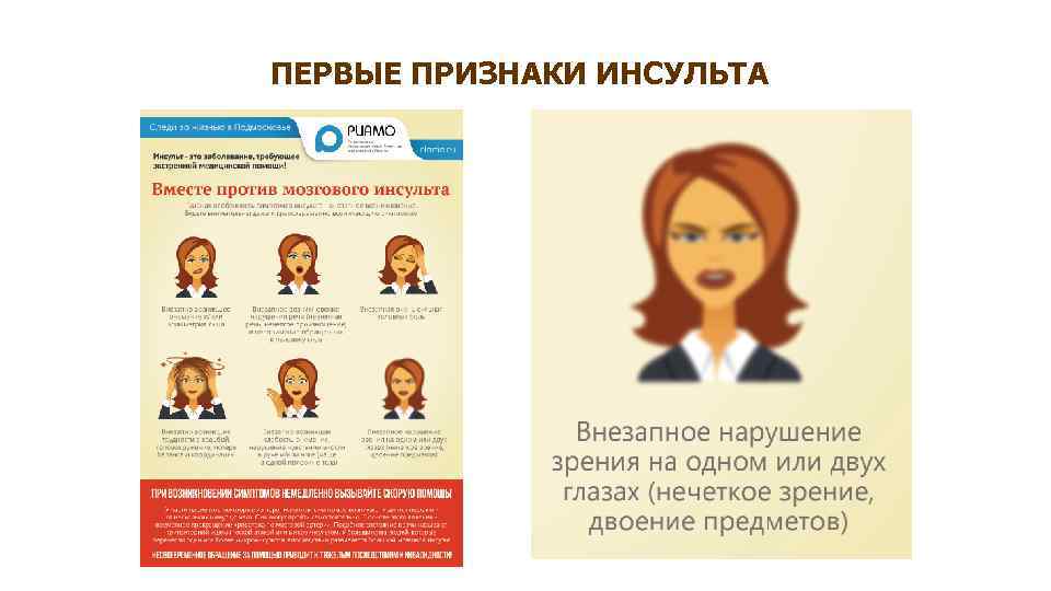 ПЕРВЫЕ ПРИЗНАКИ ИНСУЛЬТА 