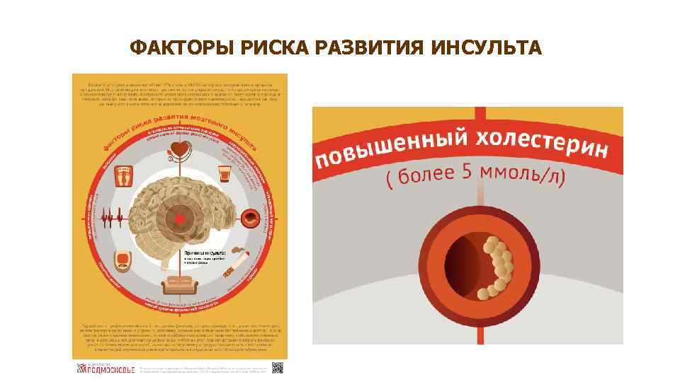ФАКТОРЫ РИСКА РАЗВИТИЯ ИНСУЛЬТА 