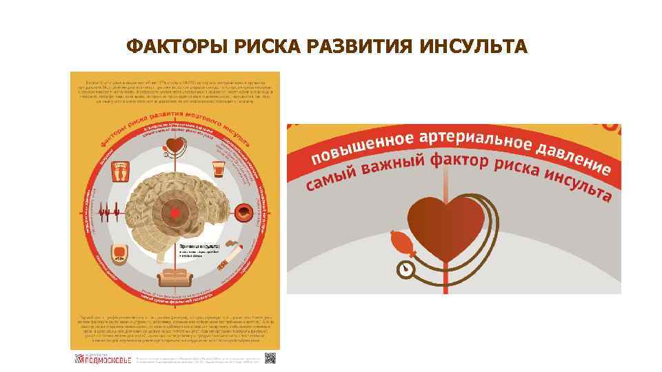 ФАКТОРЫ РИСКА РАЗВИТИЯ ИНСУЛЬТА 