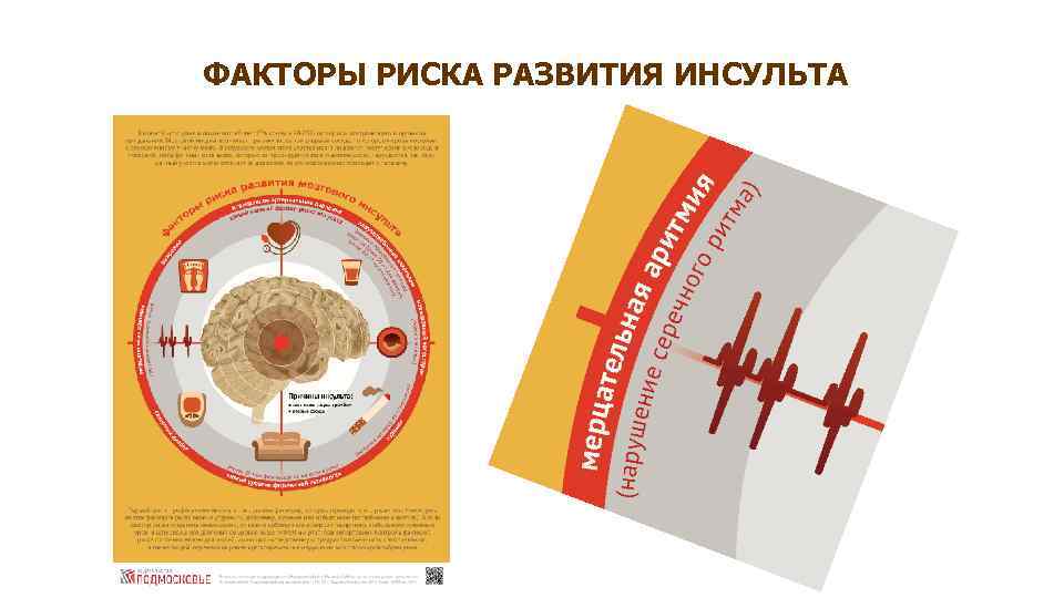 ФАКТОРЫ РИСКА РАЗВИТИЯ ИНСУЛЬТА 