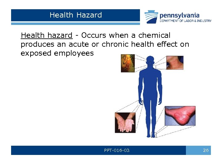 Health Hazard Health hazard - Occurs when a chemical produces an acute or chronic