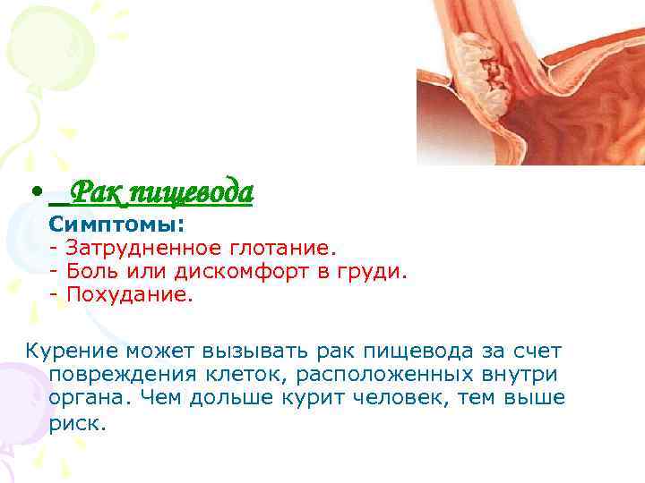  • Рак пищевода Симптомы: - Затрудненное глотание. - Боль или дискомфорт в груди.