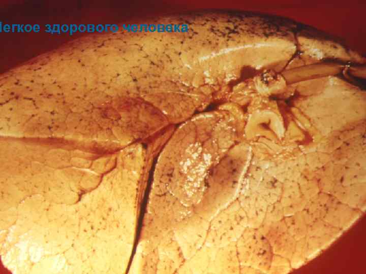 Легкое здорового человека 