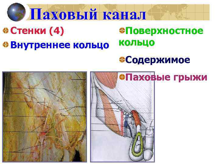 Паховый канал у детей