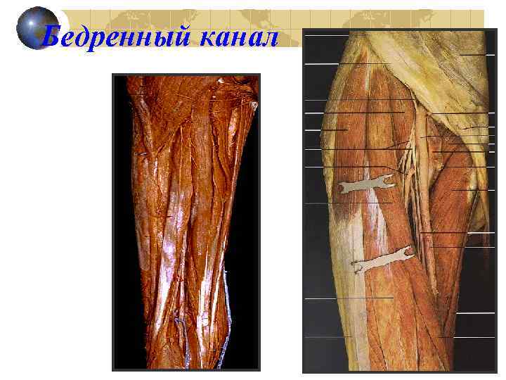 Бедренный канал 