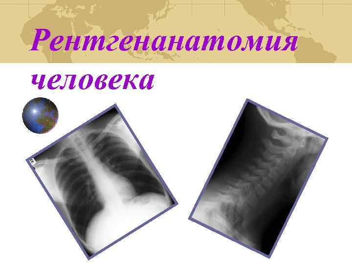 Рентгенанатомия человека 
