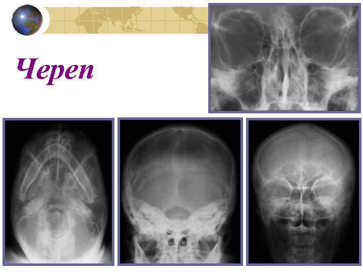 Череп 