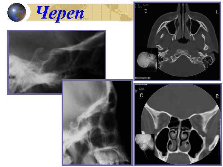 Череп 