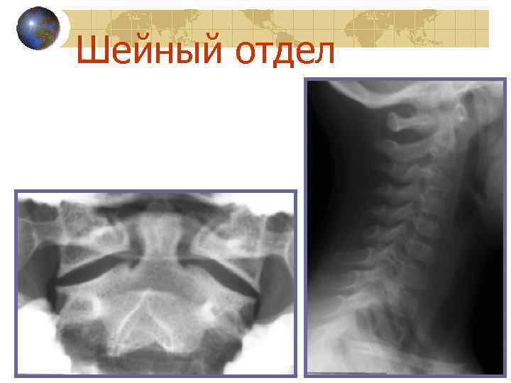 Шейный отдел 