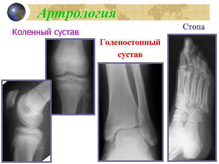 Артрология Стопа Коленный сустав Голеностопный сустав 