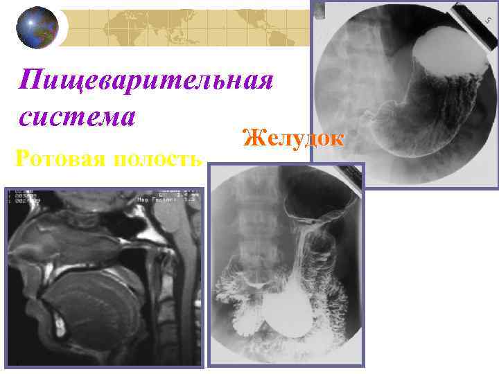 Пищеварительная система Ротовая полость Желудок 