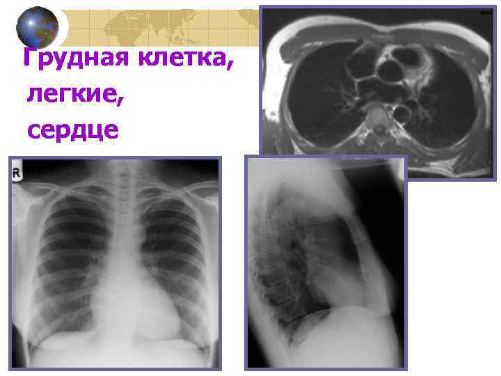  Грудная легкие, сердце клетка, 