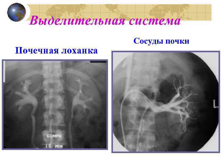 Выделительная система Почечная лоханка Сосуды почки 