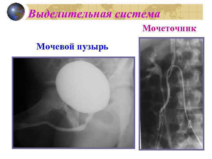 Выделительная система Мочеточник Мочевой пузырь 