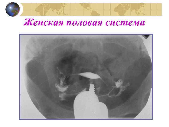 Женская половая система 