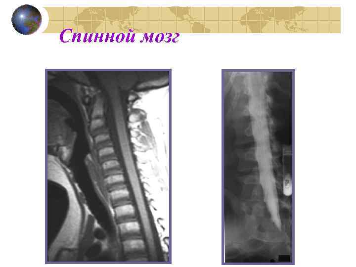 Спинной мозг 