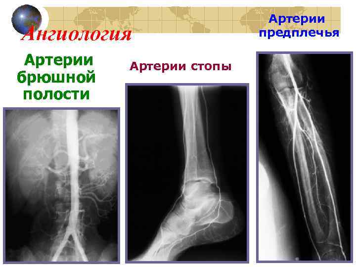 Ангиология Артерии брюшной полости Артерии стопы Артерии предплечья 