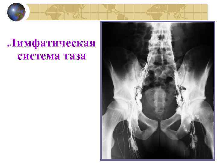 Лимфатическая система таза 