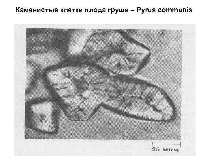 Каменистые клетки плода груши – Pyrus communis 