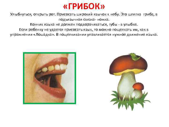  «ГРИБОК» Улыбнуться, открыть рот. Присосать широкий язычок к небу. Это шляпка гриба, а